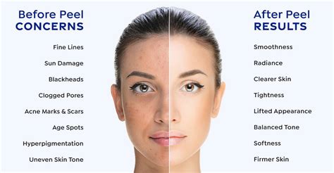 glycolic acid how long to see results|Glycolic Acid Benefits: How to Use It in Your Skin Care .